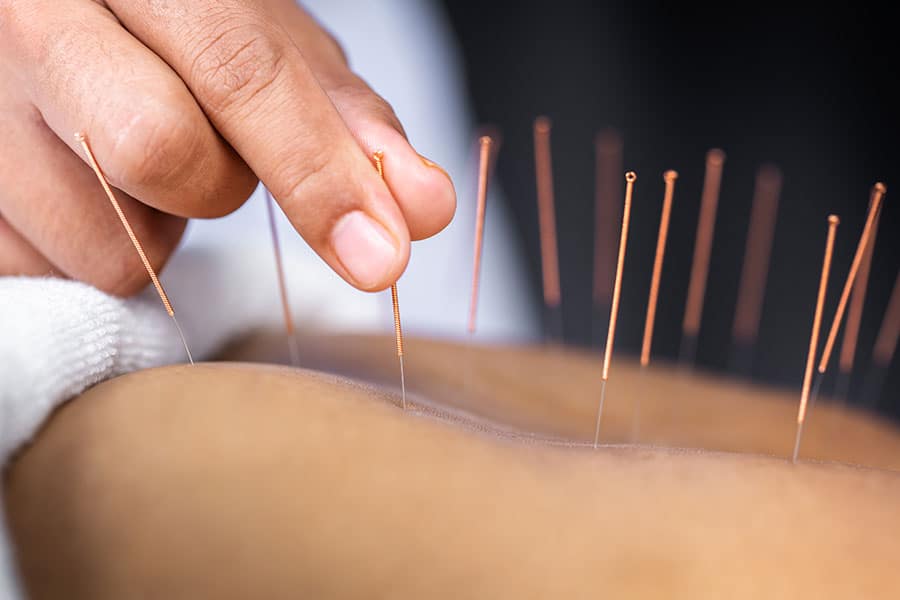 Acupuncture for Addiction